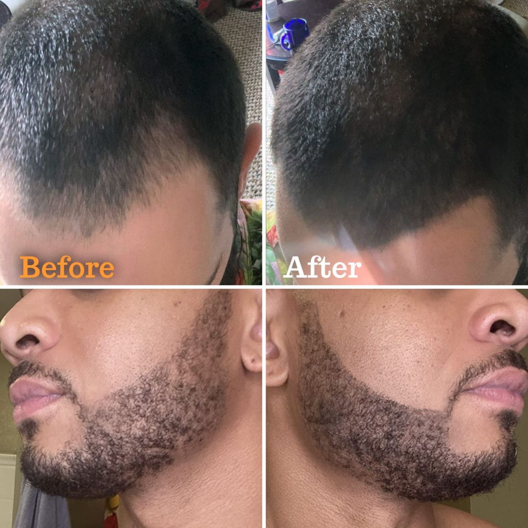 Follicle Booster Jet Black Beard Pen,X002MOYTRD