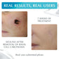 NewGel+ E Advanced Silicone Gel For Old & New Scars 15g