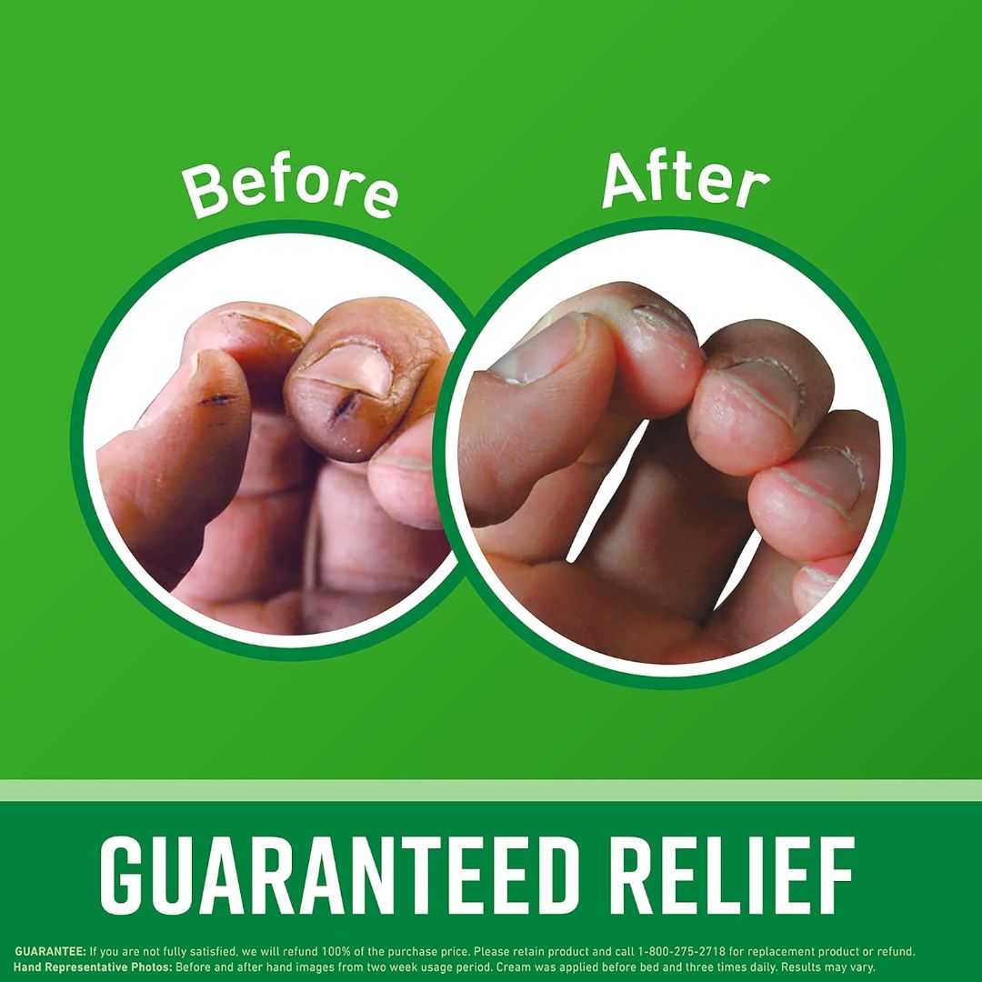 O'Keeffe's Working Hands Cream For Extremely Dry, Cracked Hands 96g,722510035005