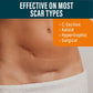 Nuvadermis Effective Scar Treatment Scar Reusable Sheets 4 Count