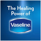 Vaseline Lip Therapy Aloe Lip Balm 20g