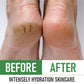 PurOrganica Urea 40% Healing Cream For Feet, Elbows & Knees 113g,867806000302