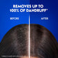 Head & Shoulders Men Hairfall Defense Anti-Dandruff Shampoo 400ml,5011321656390,
