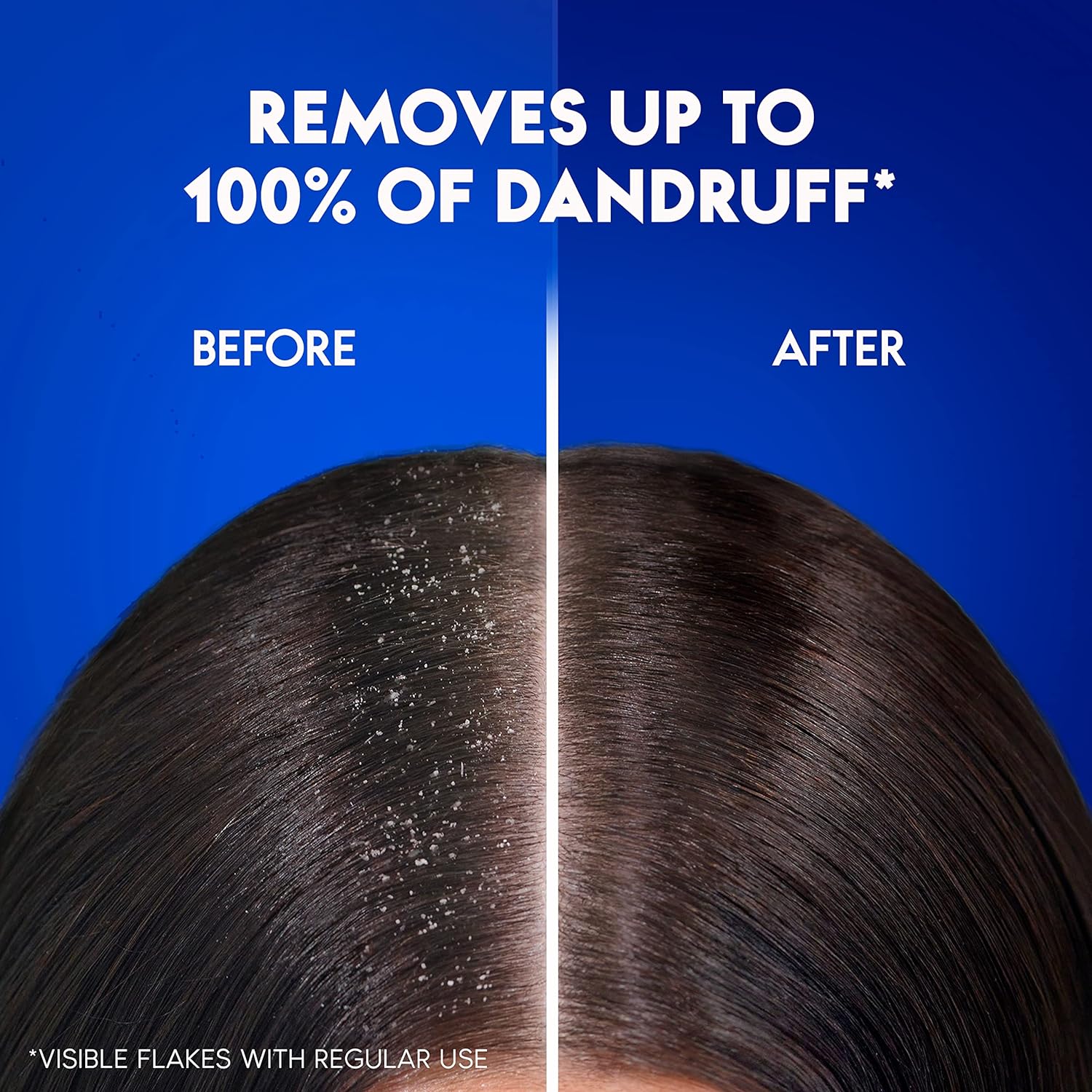 Head & Shoulders Men Hairfall Defense Anti-Dandruff Shampoo 400ml,5011321656390,