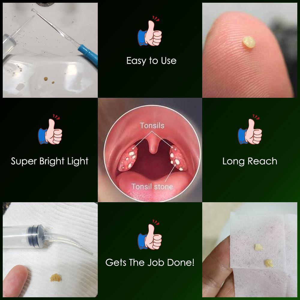 Airgoesin Upgraded Tonsil Stone Remover Tool, Yellow, 5 Tips, Tonsillolith Pick Case + 1 Irrigator Fresh Breath Oral Rinse,