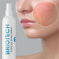 BRIOTECH BRIOTECH Topical Skin Spray, Hypochlorous Acid Spray For Body And Face, Eyelid Cleanser, HOCl Facial Mist, Support Against Irritation And Redness, Stocking Stuffers, Packaging May Vary, 4 Oz, 1 Ct