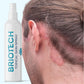 BRIOTECH BRIOTECH Topical Skin Spray, Hypochlorous Acid Spray For Body And Face, Eyelid Cleanser, HOCl Facial Mist, Support Against Irritation And Redness, Stocking Stuffers, Packaging May Vary, 4 Oz, 1 Ct