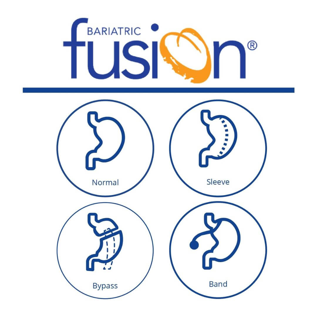 Bariatric Fusion Multivitamin Without Iron 180 Capsules,858208007778