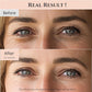 Beauty of Joseon Beauty Of Joseon Revive Eye Serum With Retinal Niacinamide Correction For Puffy Eye Bags Fine Lines Dark Circles Wrinkles, Korean Skin Care 30ml, 1 Fl.oz, 2 Packs