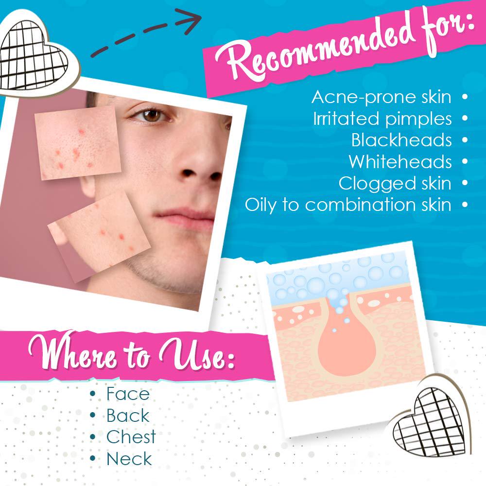 Bye Bye Blemish Acne Drying Lotion, Reduce Pimples Overnight 1oz, 1-Pack,