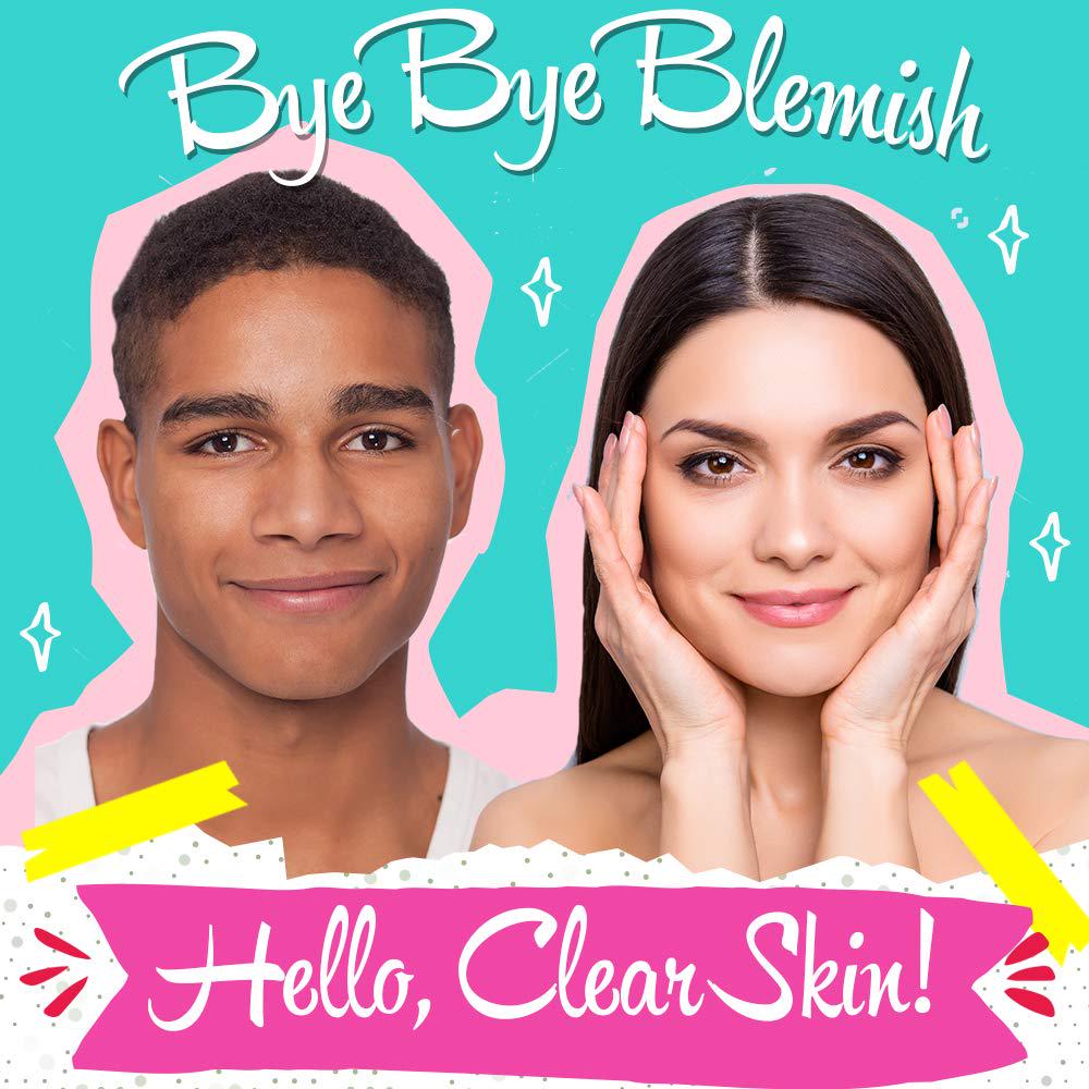 Bye Bye Blemish Acne Drying Lotion, Reduce Pimples Overnight 1oz, 1-Pack,