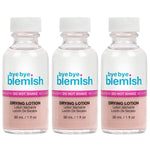 Bye Bye Blemish Acne Drying Lotion, Reduce Pimples Overnight, On-the-Spot Pimple Treatment, Beauty Skincare Essential - 1oz. (3 Pack),