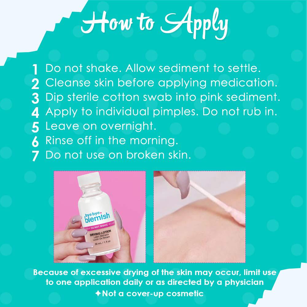 Bye Bye Blemish Acne Drying Lotion, Reduce Pimples Overnight 1oz, 1-Pack,