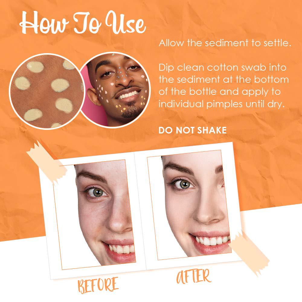 Bye Bye Blemish Dark Spot Lotion Vitamin C | Assists With Drying Blemishes And Brightening Skin | Fast Acting Solution | 1 Fl. Oz.,