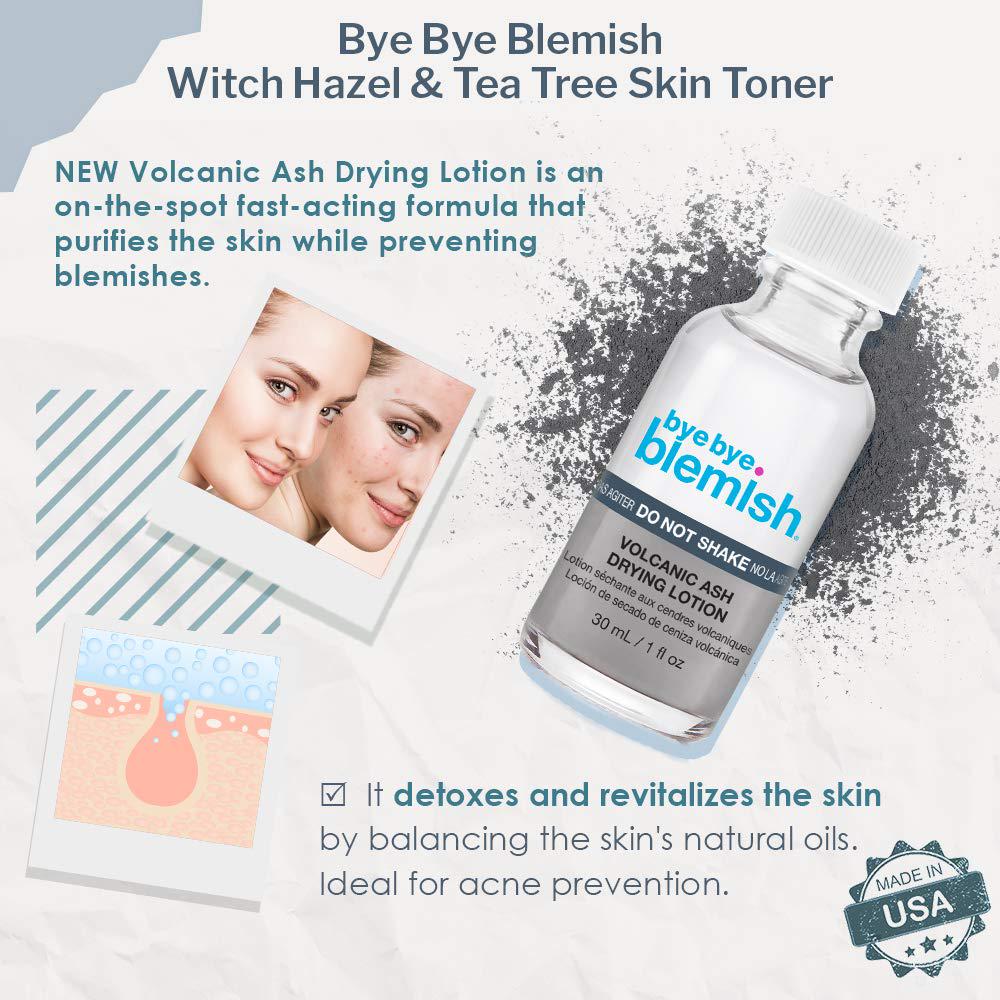 Bye Bye Blemish Drying Lotion Volcanic Ash | Acne Drying Solution To Assist With Blemish Prevention | 1 Fl. Oz.,
