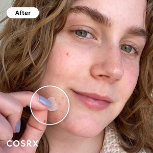 COSRX COSRX Acne Pimple Patch Absorbing Hydrocolloid Original 3 Size Patches For Zits Cover, Spot Stickers For Face And Body, Not Tested On Animals, No Toxic Ingredients (120 Count (Pack Of 5))
