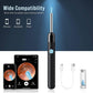LEIPUT Ear Wax Removal - Earwax Remover Tool With 8 Pcs Ear Set - Ear Canal Cleaner With 1080P Camera - FSA HSA Eligible - Ear Cleaning Kit With 6 Ear Spoon - Ear Camera For IOS And Android (Black)