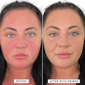 Elizabeth Mott Elizabeth Mott Thank Me Later Color Correcting Face Primer - Niacinamide And Cica Soothes And Neutralizes Uneven Skin Tone And Facial Redness - Grips Makeup For Long-Lasting Wear - Cruelty-Free, 30g