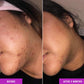 Good Molecules Good Molecules Discoloration Correcting Serum - Tranexamic Acid And Niacinamide For Dark Spots, Sun Damage, And Age Spots - Skincare Face