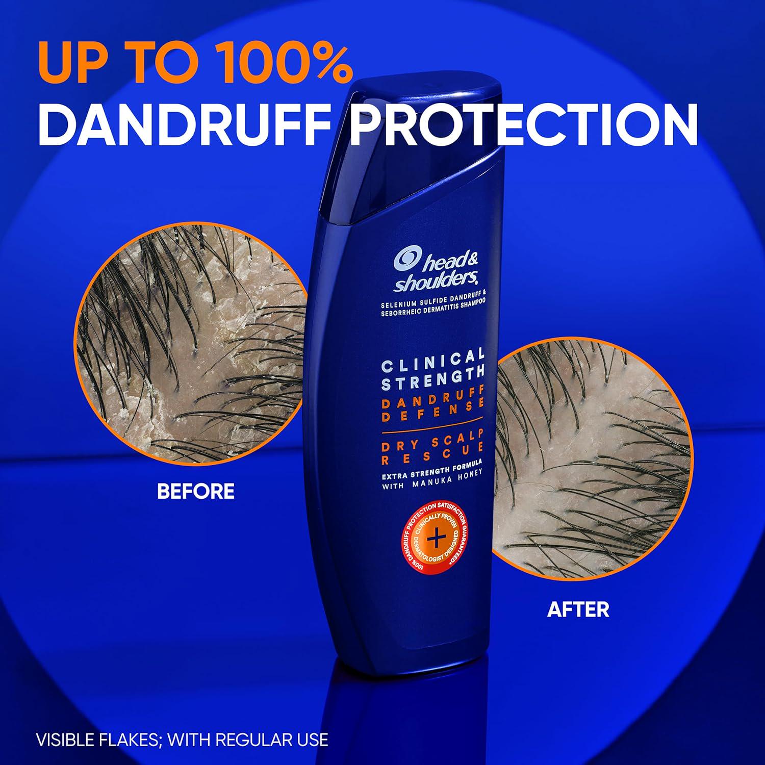 Head And Shoulders Clinical Dandruff Defense + Dry Scalp Rescue Shampoo 13.5 Oz Twin Pack,