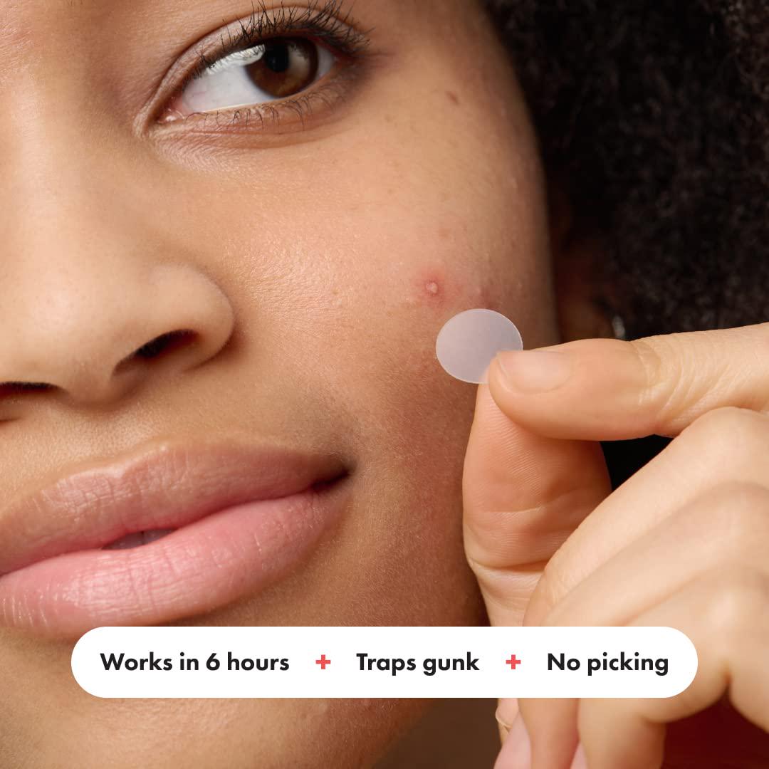 Hero Cosmetics Mighty Patch Original Patch - Hydrocolloid Acne Pimple Patch, 72 Count | For Covering Zits And Blemishes, Spot Stickers For Face And Skin,