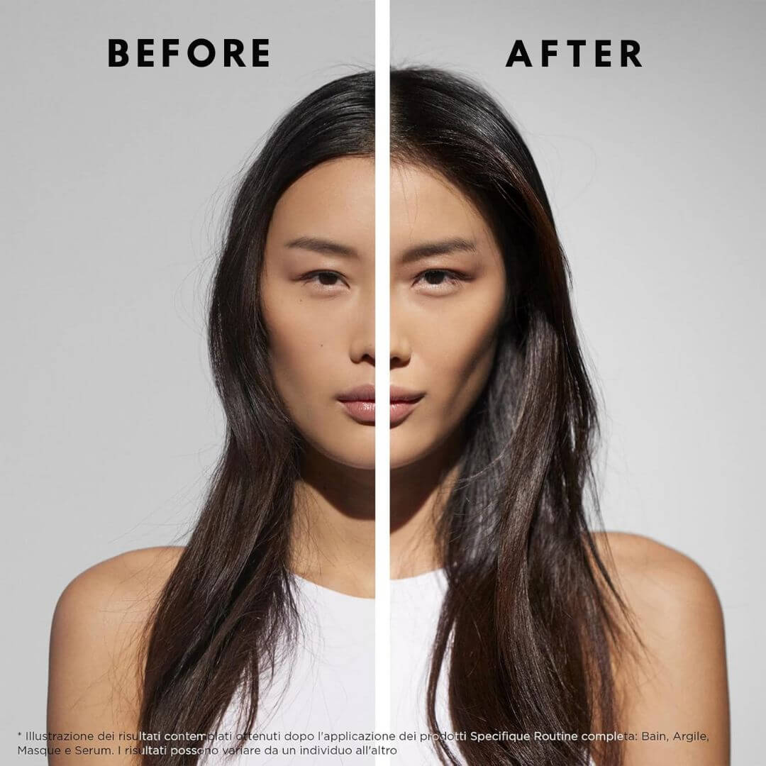 Kerastase Specifique Bain Riche Dermo Calm Cleansing Soothing Shampoo 250ml,3474636397396