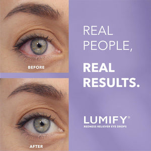LUMIFY LUMIFY Redness Reliever Eye Drops, For Whiter And Brighter Looking Eyes, 0.08 Fl Oz (2.5 ML)