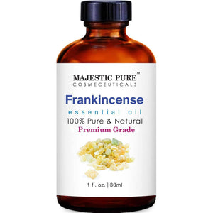 Majestic Pure Frankincense Essential Oil, 1oz, 100% Pure, Natural, for Hair, Skin, Aromatherapy, Massage & Diffuser Use