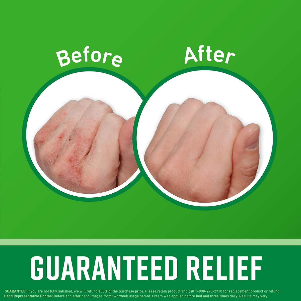 O'Keeffe's O'Keeffe's Working Hands Hand Cream For Extreme Dryness - 7 Oz Tube (1 Pack) - Repairing Skincare For Cracked, Dry Hands