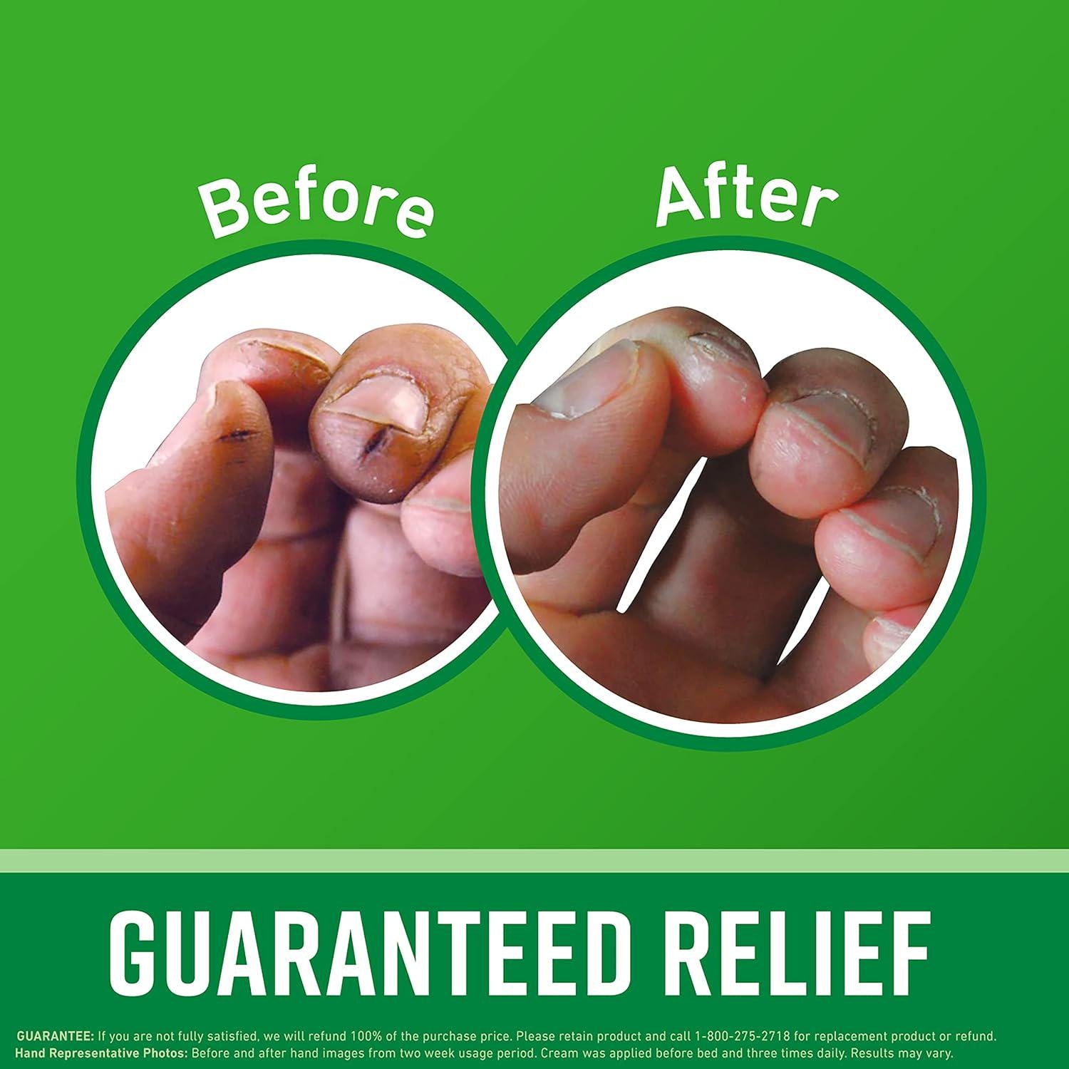 O'Keeffe's Working Hands Hand Cream For Extremely Dry; Cracked Hands; 3.4 Ounce Jar; (Pack 2),
