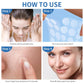 Daolyo Pimple Patches For Face, 4 Size 300 Counts Acne Patches, Hydrocolloid Patches For Covering Zits And Blemishes, Spot Stickers With Salicylic Acid, Tea Tree Oil And Calendula Oil