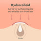 Rael Rael Pimple Patches, Miracle Invisible Spot Cover - Hydrocolloid Acne Patch, Treatment For Breakouts, Absorbs Zits And Blemish, Korean Skin Care, 2 Sizes (24 Count)
