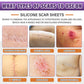 Psecici Silicone Scar Sheets,Silicone Scar Tape,Scar Tape For Surgical Scars,Silicone Scar Removal Strips For Surgical,C-Section,Tummy Tuck,Keloid Scars(1.6 X 59 Roll-1.5M) Keloid Bump Removal
