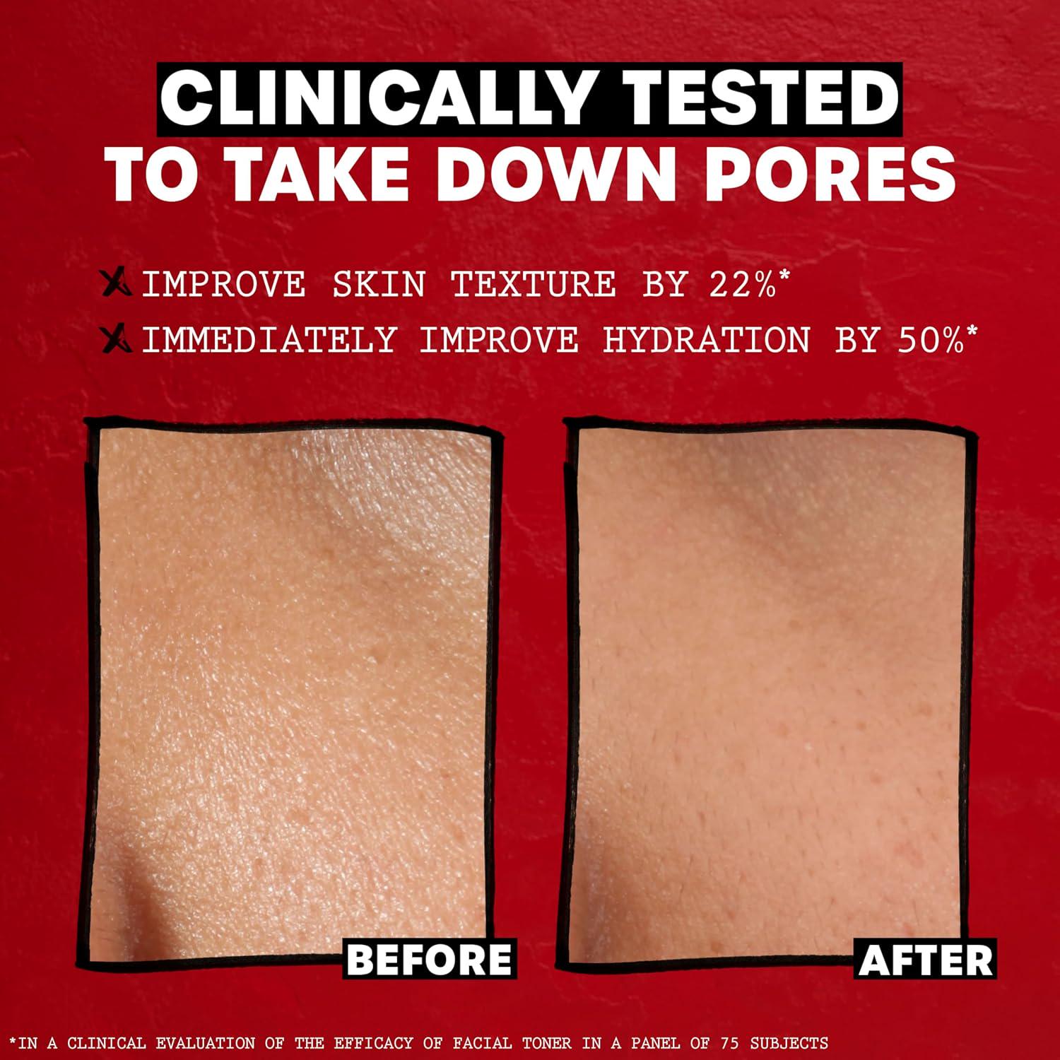 THAYERS Alcohol-Free, Hydrating, Unscented Witch Hazel Facial Toner With Aloe Vera Formula, Vegan, Dermatologist Tested And Recommended, 12 Oz (Packaging May Vary),