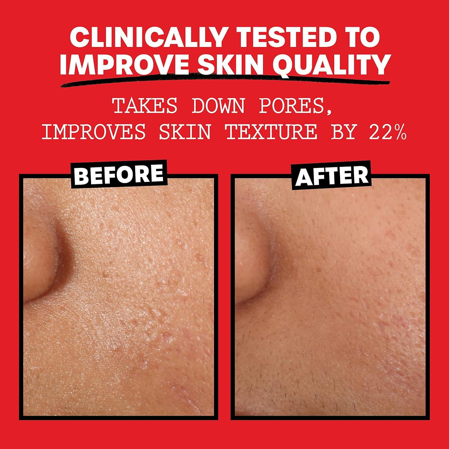 THAYERS Alcohol-Free, Hydrating, Unscented Witch Hazel Facial Toner With Aloe Vera Formula, Vegan, Dermatologist Tested And Recommended, 12 Oz (Pack Of 2),