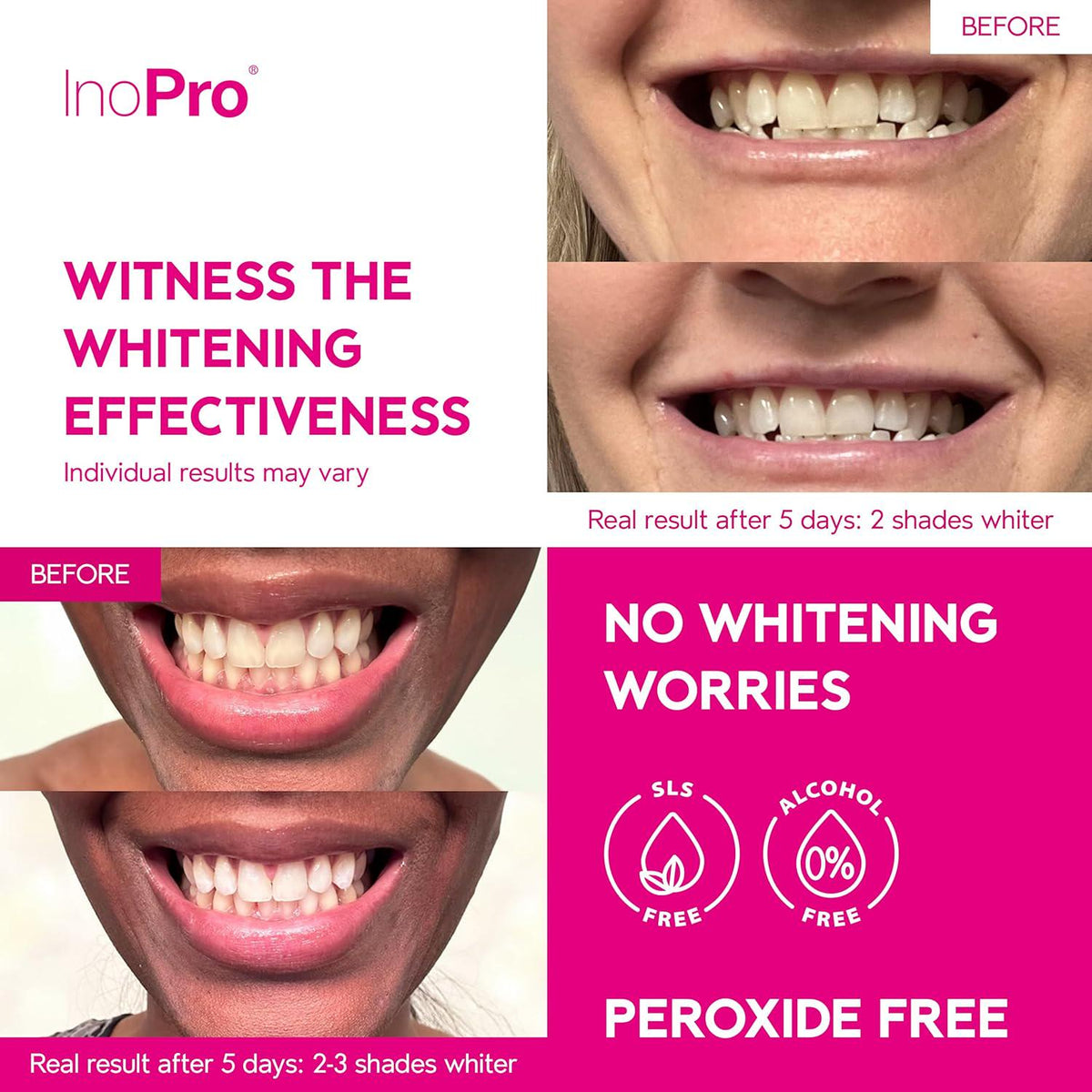 InoPro Teeth Whitening Strips 21 Treatments Kit - Teeth Whitener, Peroxide Free, Enamel Safe Green White Strips, Deep Stains Removal - Instant Teeth Whitening Without The Harm (42 Strips)