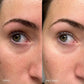 Topicals Faded Brightening Under Eye Masks | Revitalizing Patches To Depuff, Hydrate, And Illuminate | Diminishes Dark Circles And Fine Lines | Made With Kojic Acid, Caffeine And Niacinamide