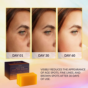 VALITIC VALITIC Kojic Acid Dark Spot Remover Soap Bars With Vitamin C, Retinol, Collagen, Turmeric - Original Japanese Complex Infused With Hyaluronic Acid, Vitamin E, Shea Butter, Castile Olive Oil (2 Pack)