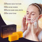 VALITIC VALITIC Kojic Acid Dark Spot Remover Soap Bars With Vitamin C, Retinol, Collagen, Turmeric - Original Japanese Complex Infused Hyaluronic Acid, E, Shea Butter, Castile Olive Oil (4 Pack)