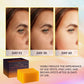 VALITIC VALITIC Kojic Acid Dark Spot Remover Soap Bars With Vitamin C, Retinol, Collagen, Turmeric - Original Japanese Complex Infused With Hyaluronic Acid, Vitamin E, Shea Butter, Castile Olive Oil (3 Pack)