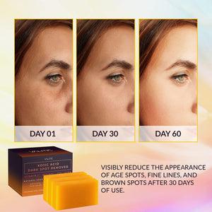 VALITIC VALITIC Kojic Acid Dark Spot Remover Soap Bars With Vitamin C, Retinol, Collagen, Turmeric - Original Japanese Complex Infused With Hyaluronic Acid, Vitamin E, Shea Butter, Castile Olive Oil (3 Pack)