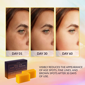 VALITIC VALITIC Kojic Acid Dark Spot Remover Soap Bars With Vitamin C, Retinol, Collagen, Turmeric - Original Japanese Complex Infused Hyaluronic Acid, E, Shea Butter, Castile Olive Oil (4 Pack)