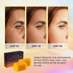 VALITIC VALITIC Kojic Acid Dark Spot Remover Soap Bars With Vitamin C, Retinol, Collagen, Turmeric - Original Japanese Complex Infused With Hyaluronic Acid, Vitamin E, Shea Butter, Castile Olive Oil - 5 Pack