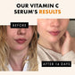 Eclat Skincare Vitamin C Face Serum - Dark Spot Serum, Vit C Serum With Hyaluronic Acid, Ferulic Acid, And Vit E - Anti Aging And Skin Brightening Serum, Pure Vitamin C Serum Skin Care 30 Ml