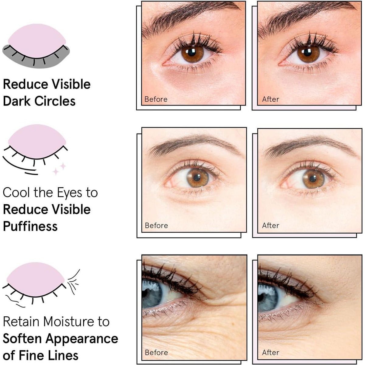 grace & stella Grace And Stella Award Winning Under Eye Mask Reduce Dark Circles, Puffy Eyes, Undereye Bags, Wrinkles, Gel Under Eye Patches, Birthday Gifts For Women - Vegan Cruelty-Free Self Care (24 Pairs, Blue)