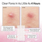 grace & stella Grace And Stella Pimple Patches For Face - Fast Acting Hydrocolloid Acne Patch That Absorb Gunk, Flatten Breakouts - Zit Stickers For Clear Skin - Dermatologist-Tested, Vegan (Invisible, 36 Count)